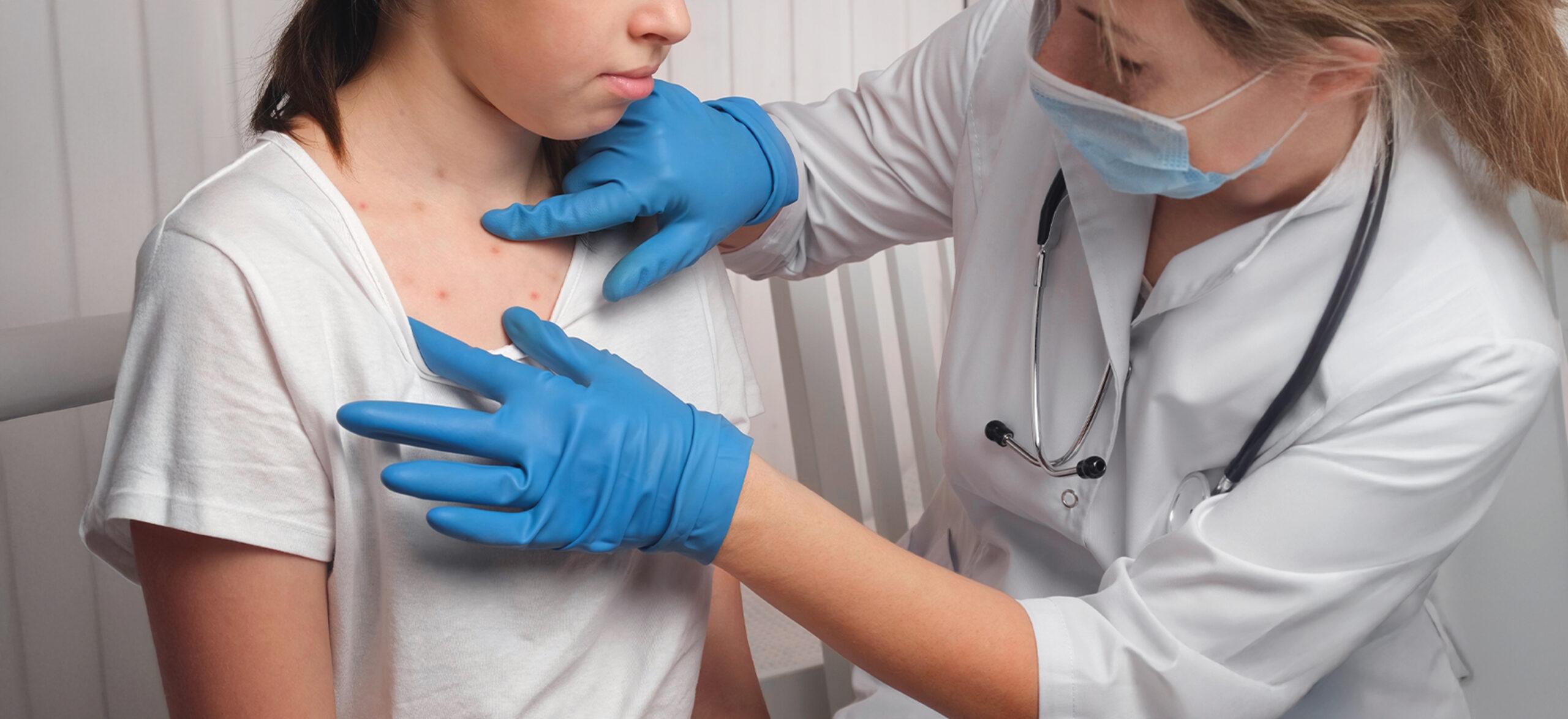 A girl with a red rash from measles is being examined by the physician